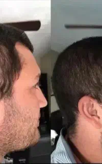 ریش و مو پرپشت . دوباره