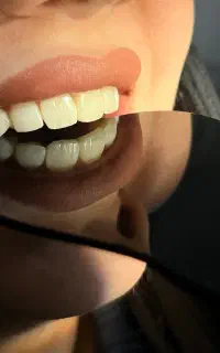 خدمات اقساطی دندانپزشکی و زیبایی دندان