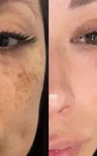 کرم شب روشنکننده