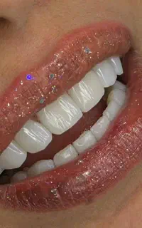 کامپوزیت فقط سرو