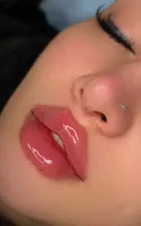 تزریق تخصصی ژل و بوتاکس و فیلر بدن و جوانساز ها