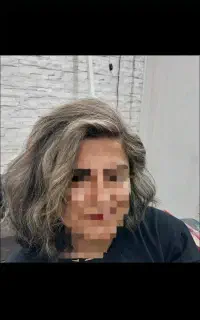 اپلاسیون و رنگ مو تخصصی