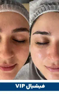 فیشیال فقط 500زیباشهر