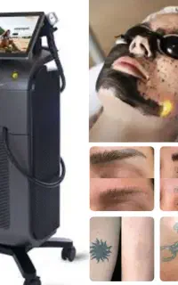 انواع خدمات لیزر مو و روشن کننده و حذف تتو