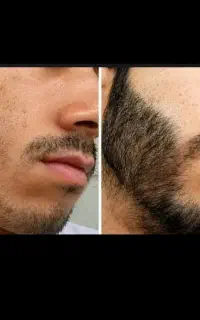 موبایل ریش