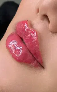 مدل تزریق ژل لب بوتاکس فیلر مزو جوانساز مادلینگ۸۵۰