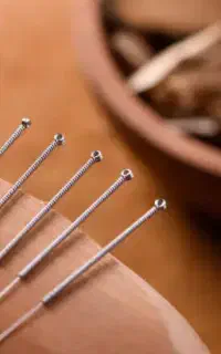 آموزش طب سوزنی مقدماتی
