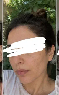 اگر حال پوستت خوب نیست یه نگاه بنداز