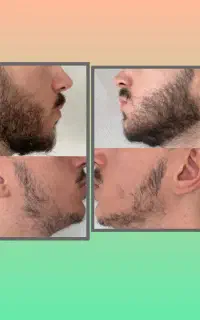 خوراک ریش سیبیل هات دست منه