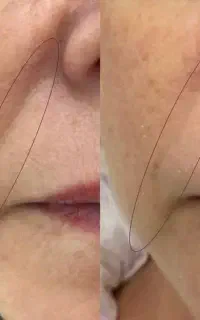 کرم. کلاژن بیوممتیک اکسیر جوانی