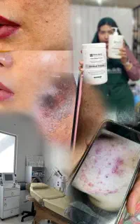 تخفیف ویژه فشیال تخصصی عیدقربان