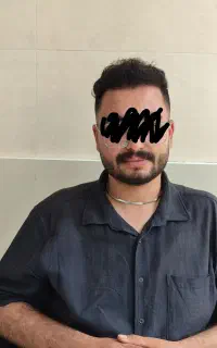 کاشت مو و ابرو با شرایط ویژه اقساط