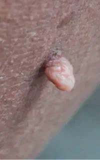از شرش خلاص شو
