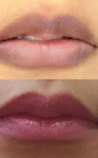 جشنواره تخفیفی شیدینگ لب واصلاح تیرگی و بدرنگی لب