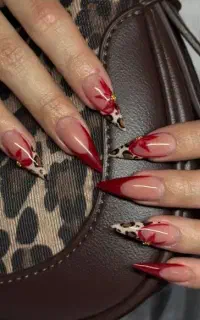 کاشت کره ای مطهری تخفیف ۵۰ درصدی