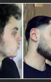 ریش هاتو جنگل کن