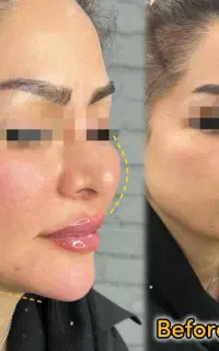 کلینیک زیبایی و مرکز لیزر دژآباد در رودسر