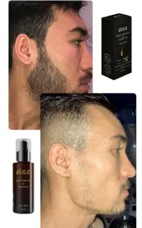بصورت تضمینی فقط تو ۲۵ روز ریش دربیار.