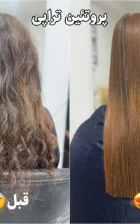 پکیج عیدانه پروتئین تراپی( فرصت محدود)