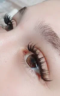 کاشت مژه