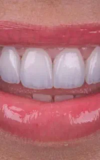 خدمات تخصصی زیبایی دندان