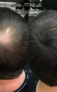 فقط اگه ریزش مو داری این آگهی رو بازکن