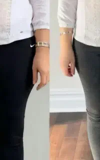 لاغری و کاهش وزن واقعی با روش نوین در مطب
