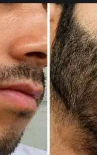 ریش و ابروهاتو پرپشت کن