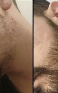 ریش امضای چهرته