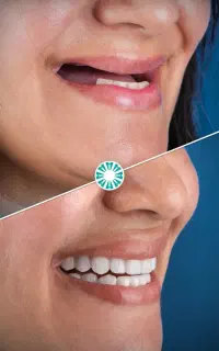 دندانپزشکی تخصصی،کاشت ایمپلنت با ضمانت+اقساط ویژه