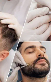 آموزش تخصصی کاشت مو ابرو ریش مزو و پی ار پی