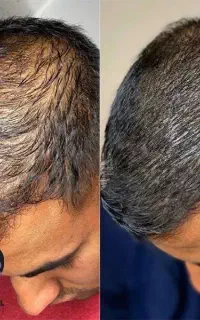 ۲ ماه همش درمیاد