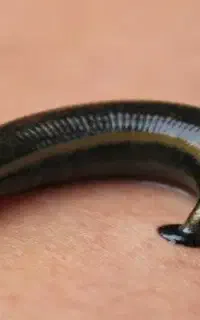 زالو طبی ارایشی