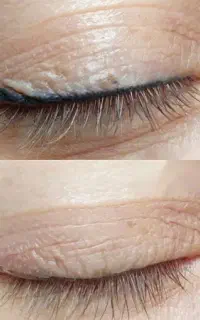 پاک کردن تتوی ابروو..برداشتن خال و..روشن کردن پوست