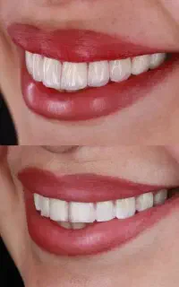 مرکز تخصصی کامپوزیت و لمینیت