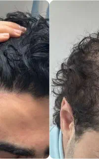 این اخرین روشیه که امتحان میکنی