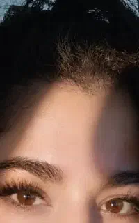 کاشت مژه