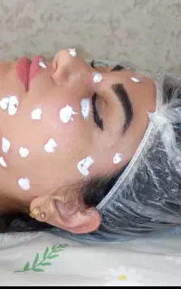 برداشتن تخصصی انواع خال های گوشتی