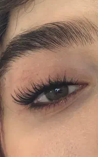 کاشت مژه