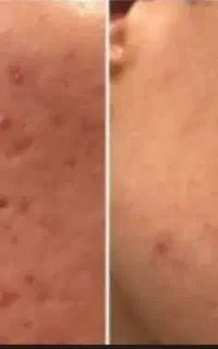 مشاوره رایگان پوست و لاغری