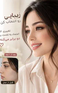 جشـنواره عمل بینی اقساطی
