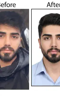 عکس فوری 8 عدد 250 ت