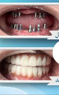 کلینیک تخصصی دندانپزشکی و ایمپلنت در سیرجان