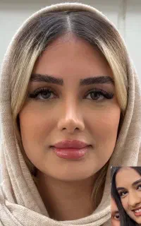 عمل بینی رینوپلاستی