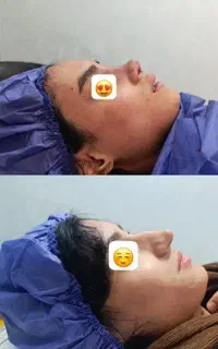 تا عید به فرم دلخواه بینی تون برسید(تیپ پلاستی )