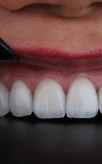 استخدام دستیار دندانپزشک