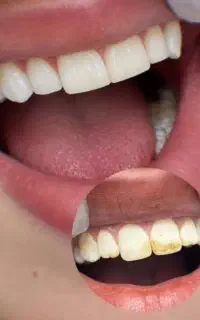 راهنمایی دندون پزشکی