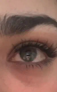 کاشت مژه فقط 380