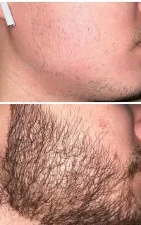 این آخرین روشیه که امتحان میکنید