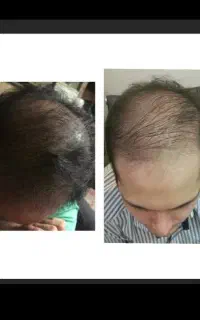 پوستت لایق بهترینه